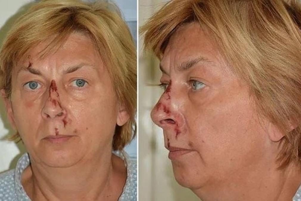 Identificada mulher com amnésia encontrada em ilha na Croácia