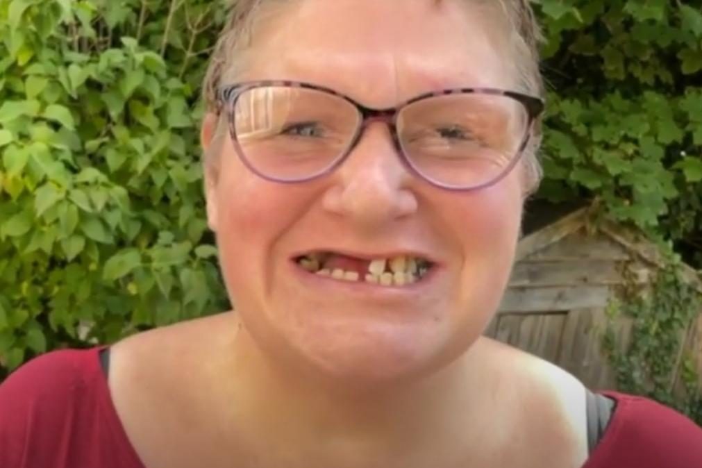 Mulher arranca 11 dentes por não ter dinheiro para ir ao dentista