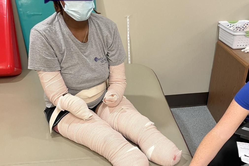 Covid-19: Mulher não vacinada fica sem pernas e braços após ser infetada [vídeo]