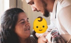 Mãe de 'bebé sem rosto' faz apelo para ajudar a pagar tratamentos