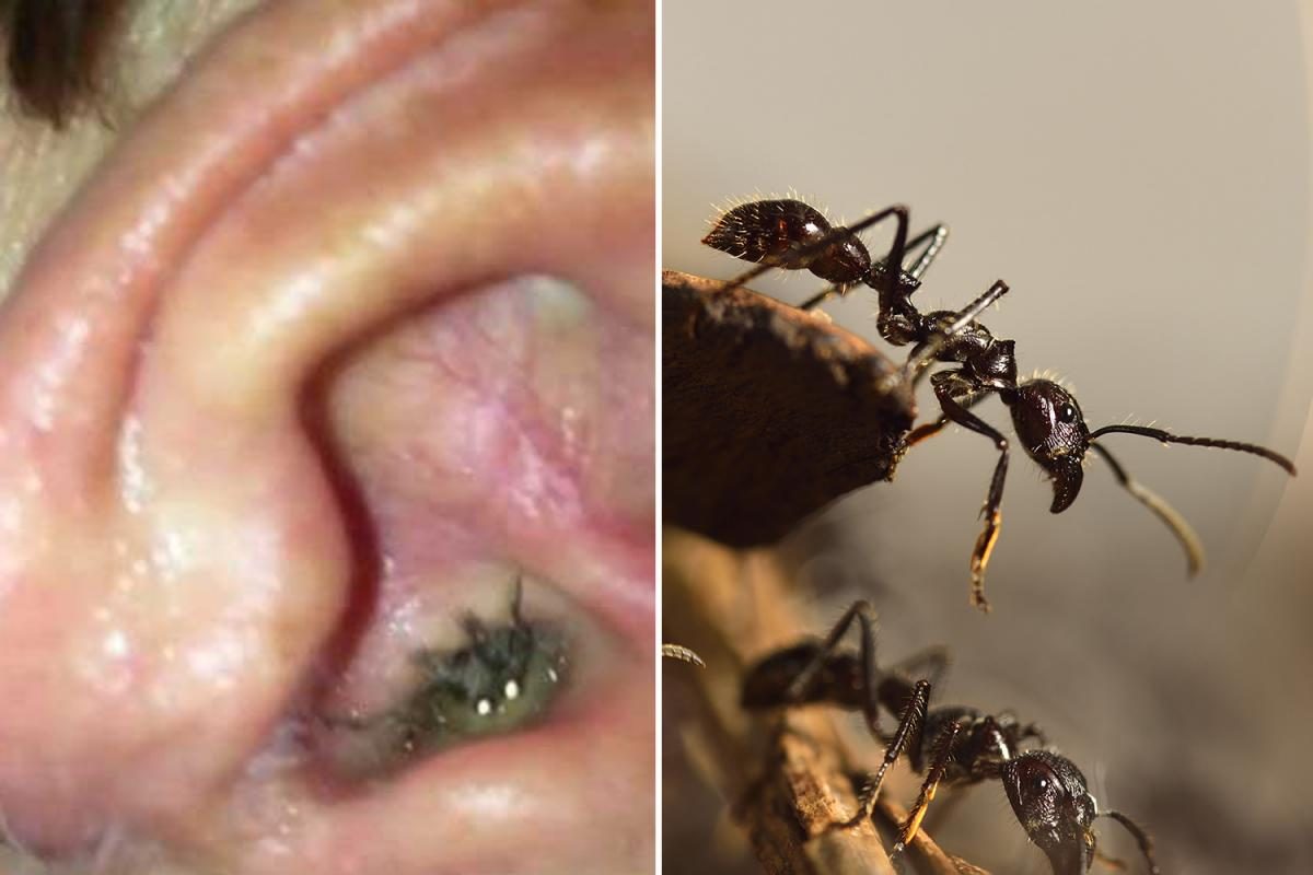 Queixa-se de dores nos ouvidos e médicos descobrem colónia de formigas [vídeo]