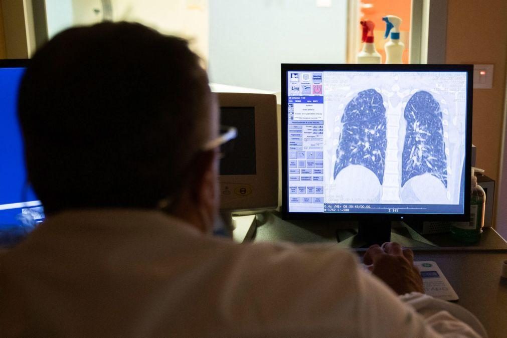 Investigadores desenvolvem técnica não invasiva para caracterizar cancro do pulmão