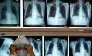 Mortes por tuberculose aumentaram na Europa pela primeira vez em 20 anos
