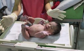 Número de nascimentos recuperou no 1.º trimestre com mais 1.402 bébes face a 2021